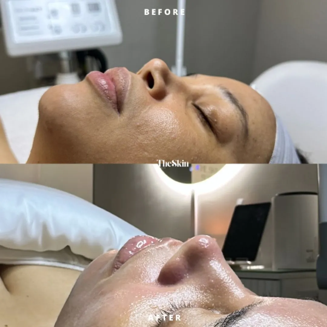 Head Spa Instagram Post 3