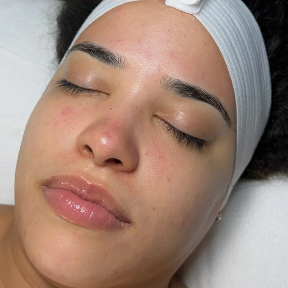Facial After Picture